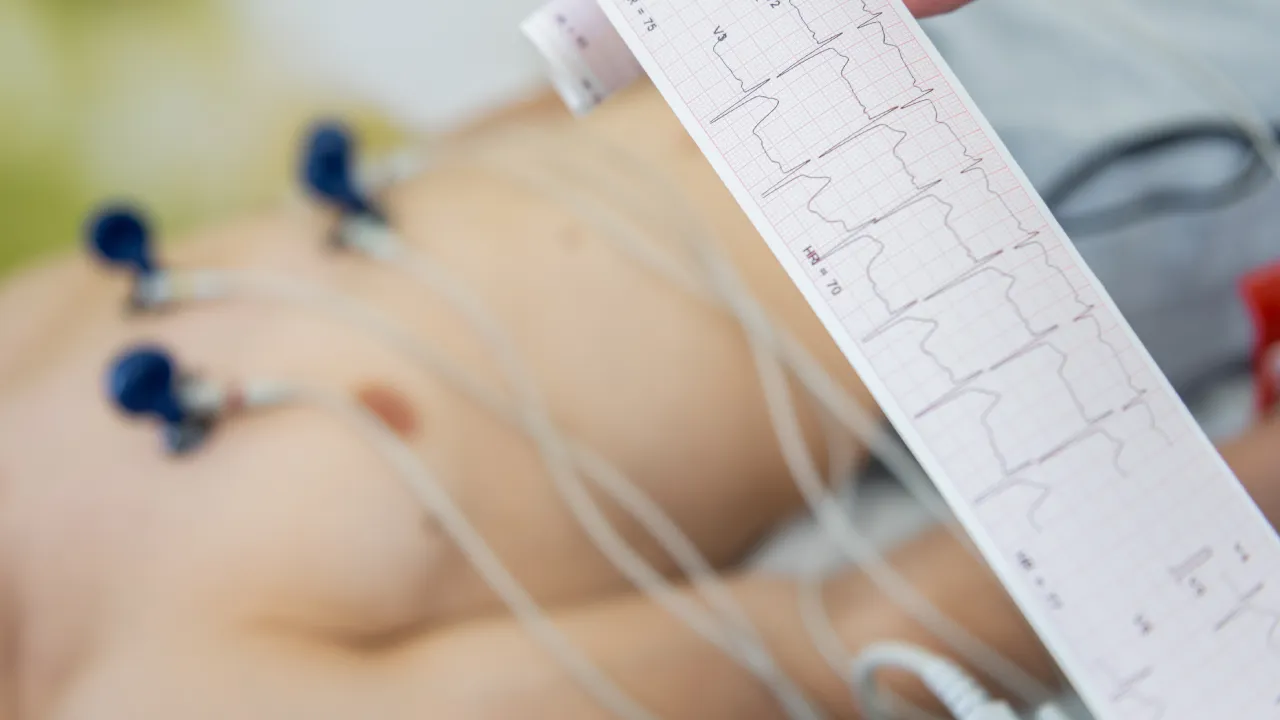 Elettrocardiogramma da sforzo nello sport: quando è necessario?